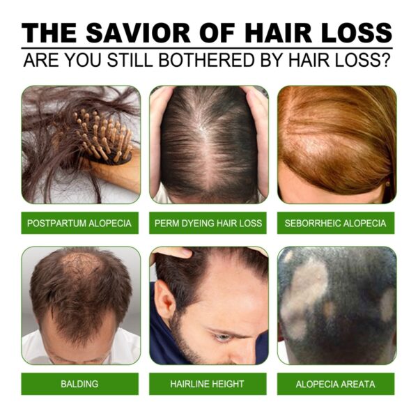 100ml Hair Growth Products Essence Fast Regrowth Serum Beard Growth Oil Hair Loss Care Beauty Scalp 2
