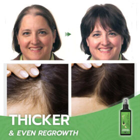 Hair Growth Nourishing Ginger Spray - image 8