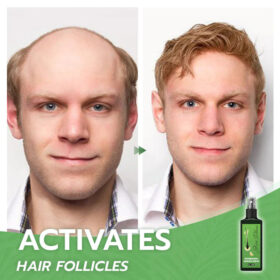 Hair Growth Nourishing Ginger Spray - image 7