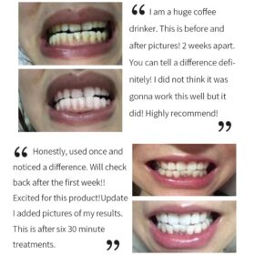 Intensive Stain Removal Toothpaste Cleansing Foam - image 4