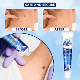 Instant Blemish Treatment Cream - image 2
