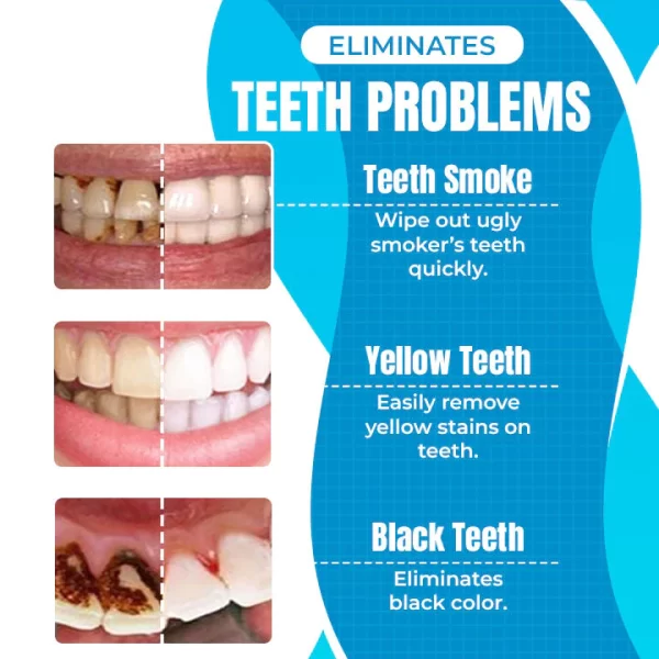 20221025 TeethActiveWhiteningBlueLamp Graphic 02 Vryan