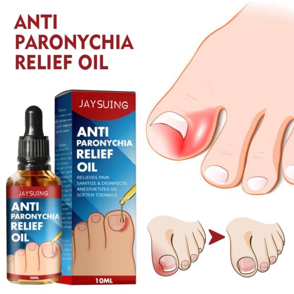 Anti Paronychia Relief Oil Cure Pain Reduce Ingrown Toenails Drops Corrector Repair Liquid Anti fungal Disinfects