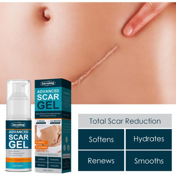 Acne Scar Removal Cream Pimples Stretch Marks Scar Gel Smoothing Body Skin Care Promote Cell Regeneration 1