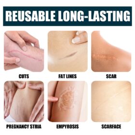 Advanced Scar Removal Gel - image 2