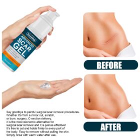 Advanced Scar Removal Gel - image 3