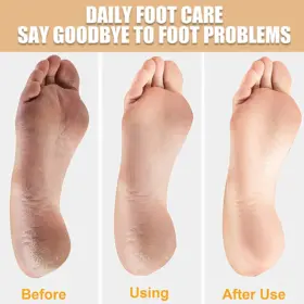 Double Side Foot File - image 2