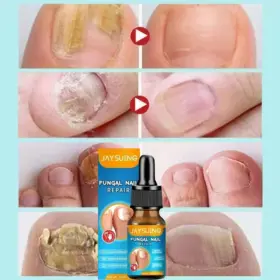 Anti Paronychia Relief Oil - image 4